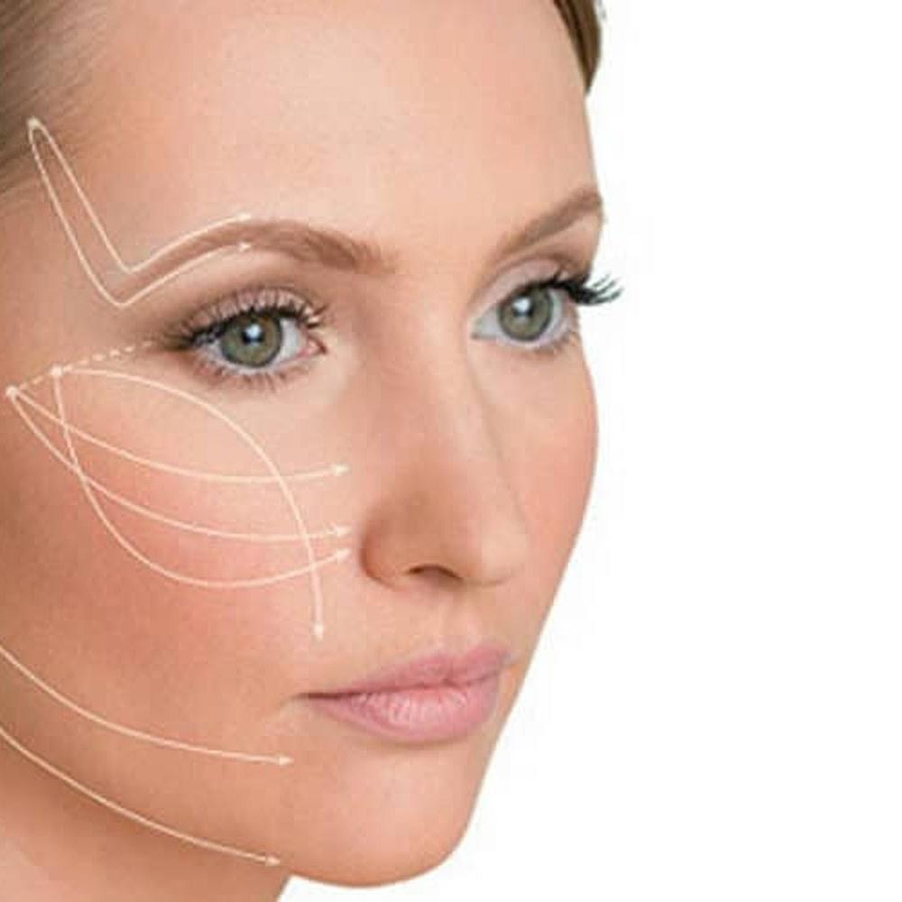 Procedimento Bioestimuladores de Colágeno (Sculptra® e Radiesse®)